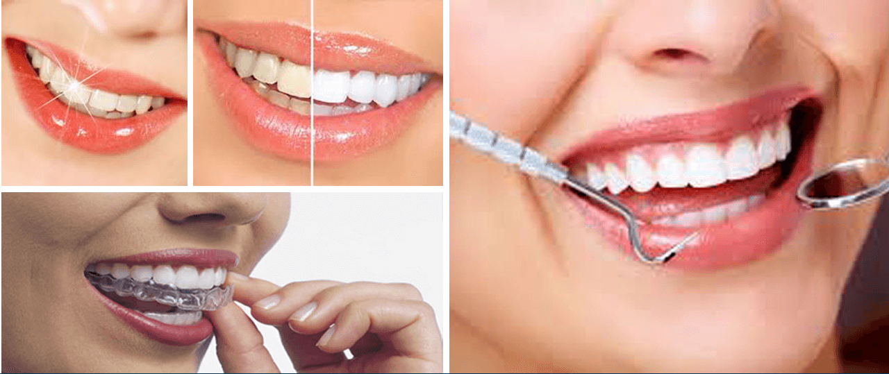 dentalexperts-banner2